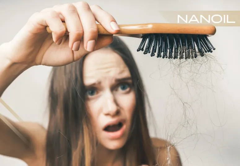 Příčiny vypadávání vlasů. Jak zvýšit objem vlasů a zabránit jejich vypadávání?